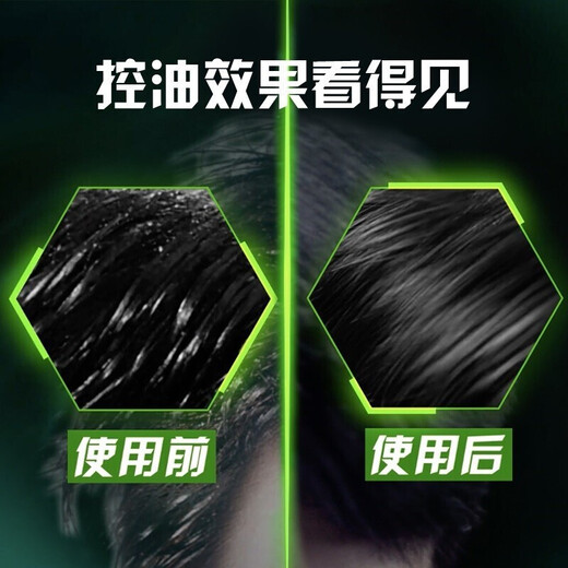 清扬(CLEAR)洗发露清爽控油去屑止痒洗头膏水润蓬松男女洗发水 清爽控油(旅行装） 100g*2瓶