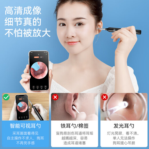XKJ【德国品质】可视挖耳勺掏耳神器掏采耳工具高清智能朵内窥镜发光 FA白色 带防尘盖【13个配件 9900万像素】
