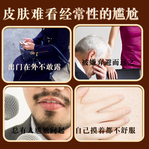 Hong Kong Pharmacy Fish Scale Skin Moisturizing Cream Snake Skin Leg Texture Special Hair Follicle Keratosis Peeling Skin Moisturizing Body Lotion Package 1 box (100g) Initial effect Fading lines