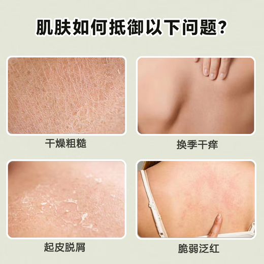 Fushiting 20% urea vitamin E body cream to prevent dryness and remove rough chicken skin in autumn and winter moisturizing moisturizing lotion urea vitamin E body lotion 200ml*2 200ml/bottle