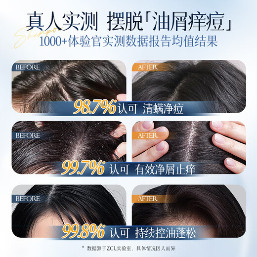Shampooing zcl Sélénium disulfure anti-phase anti-ithit