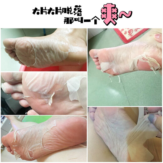 Miyi Meow Foot Mask Lactic Acid Peeling Foot Patch Tender Foot Does Not Hurt Skin Foot Care Foot Mask for Girls