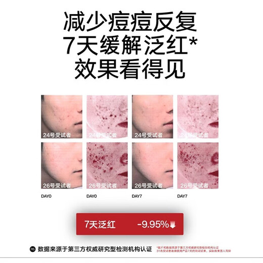 Li Ran Facial Cleanser for Men's Anti-acne Oil Control and Acne Marks and Acne Cleanser Deep Cleansing Skin Care Products for Boyfriend Set [Fragrance Cleansing] Anti-acne Cleansing + Wooden Fragrance