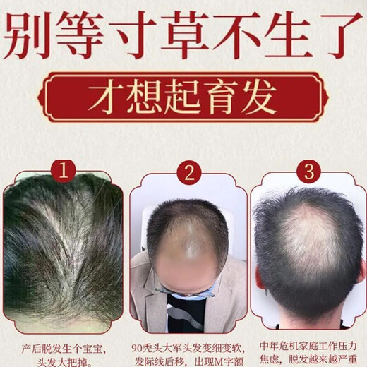 南京同仁堂生姜洗发水防脱育发洗发水脱发固发控油草本老姜王400ml*1+泵头*1