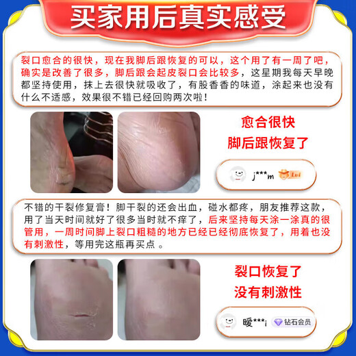 Hong Kong Pharmacy Cracked Heels Cream Fungal Infection Cracked and Peeling Feet Cracked Anti-Crack Moisturizing Moisturizing Foot Cream w1 in a box with quick results