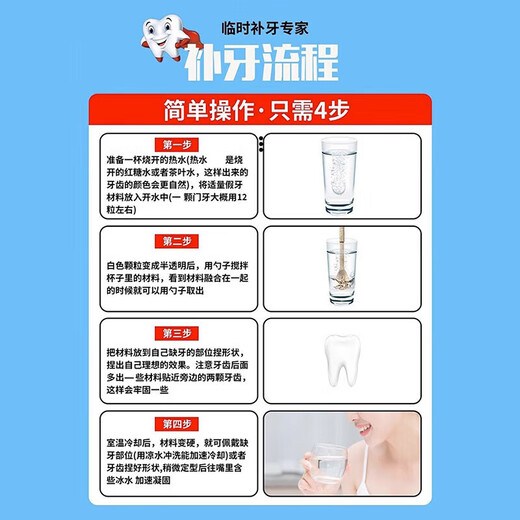 Filling materials: self-filling imported nano-resin, self-blocking cavities at home, repairing cavities and bad tooth fillings, 1 box, trial pack, 10 fillings