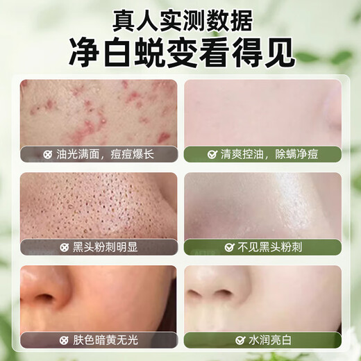 HIEUAILR德国胖东氨基酸美白洗面奶控油祛痘除螨虫去黑头角质男女士专用洁 一盒装【美白祛痘控油】
