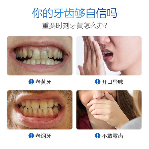 SmileKit [nicht zufrieden mit der vollen Rückerstattung] Zahn Beauty -Aufkleber, weiße Zähne, gelbe Zähne, weiße Zähne, weiße Zähne, weißer Buntzähneaufkleber, eine Schachtel (7 bis 14 Aufkleber)