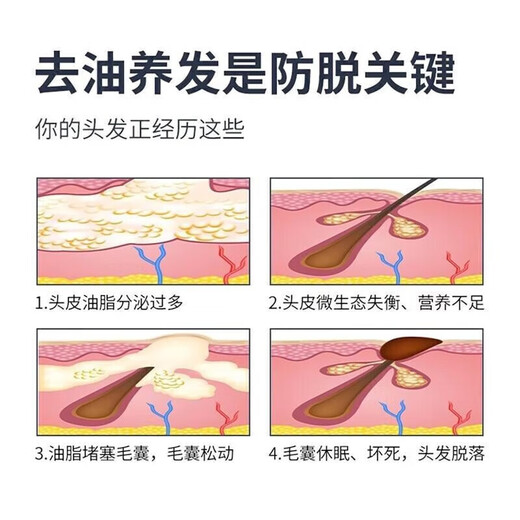 南京同仁堂防脱育发洗发水生姜洗发露头发增长密固发增长脂溢性脱发严重男女 一瓶装400ml【医师认证】