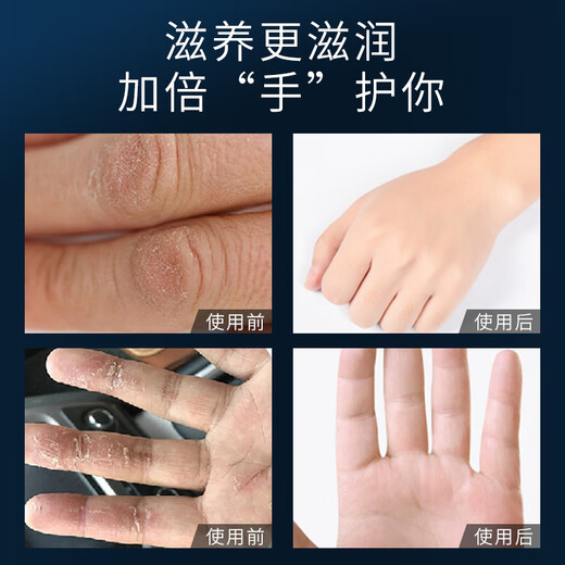 Sakose Vaseline Niacinamide Men's Special Hand Cream 2 bottles to prevent dryness and moisturize as a birthday gift gift box for boys