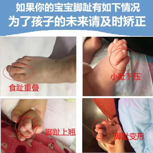 Baby and Children's Big Foot Toe Valgus et Backle Toe Correction Dispositif pour les enfants Toe à orteil curvé Splitter Yunan Yunfang Pharmacie Pharmacie (826) 1 à 8 ans White Five-Finger Toe Splitter / Deux paires les deux tailles