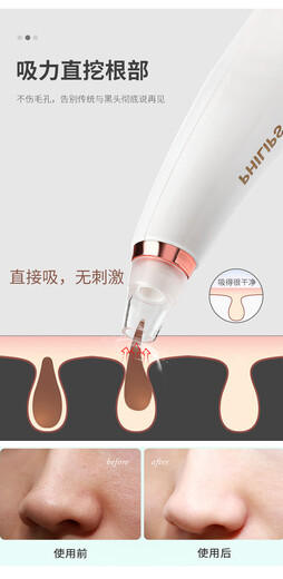 Инструмент для аспирации черных точек Philips, электрическая аспирация пор, удаление прыщей, устройство для аспирации черных точек, очищение и умывание лица, белый