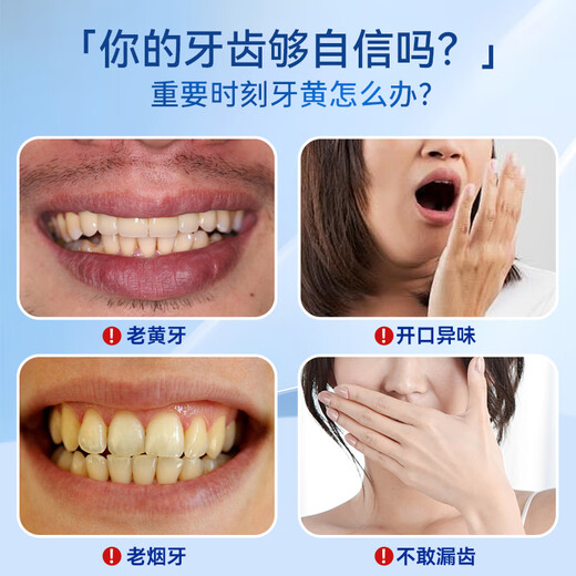 SMILEKIT 炫白牙贴牙齿贴片温和亮白美去牙黄牙烟渍黑牙口气清新14对28贴