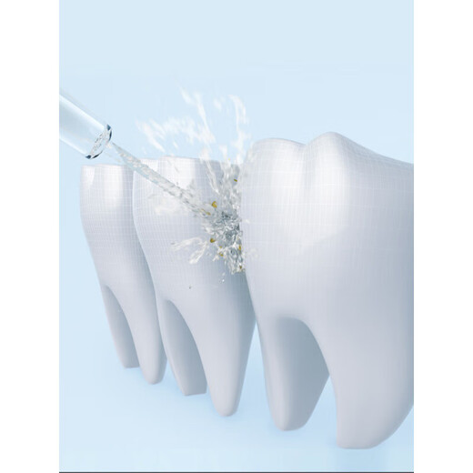 Bixiang Bixiang Máquina de descarga de dientes para la limpieza de los dientes domésticos Agua portátil Flosa Dientes orales Limpieza de dientes orales 847 [con 4 boquillas] Bixiang Máquina de descarga de dientes portátiles Menta verde