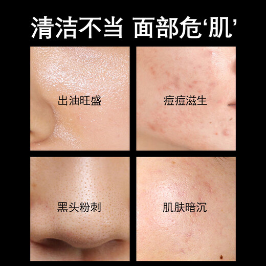 Binee Salicylic Acid Cotton Tablets Oil Acne Skin Cleansing Blackheads Pores Alcohol-Free 0.5% Mild Salicylic Acid 55 Tablets (Green)