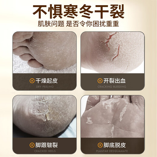 KOOGIS horse oil anti-cracking ointment for cracked hands and feet, horse oil ointment, Vaseline, cracked heels, cracked heels, hand cream