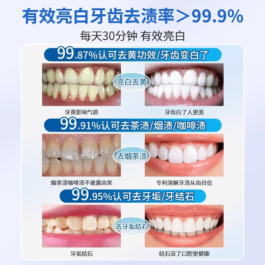 EMK whitening teeth strips, whitening teeth strips, removing yellow teeth, whitening teeth strips, whitening enzyme whitening teeth whitening strips, 1 box [14 patches = 7 pairs]