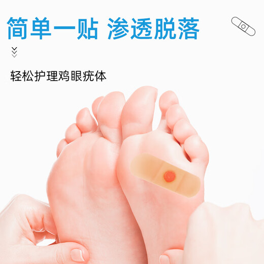 Pediatric doctor corns patch corns ointment for adults to remove foot thorns, toes, calluses, and foot pads to fall off