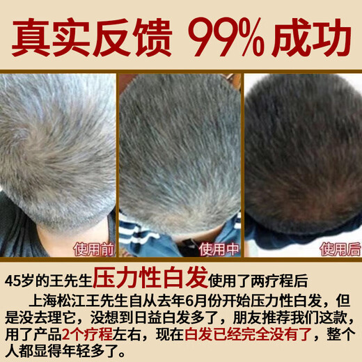 
In the inner court, use Beijing Tongrentang Polygonum multiflorum shampoo black Ganoderma lucidum white hair to promote natural nourishment and cure roots of young, middle-aged and elderly people with anti-dandruff. Gloss 500ml 1 bottle Polygonum multiflorum black hair