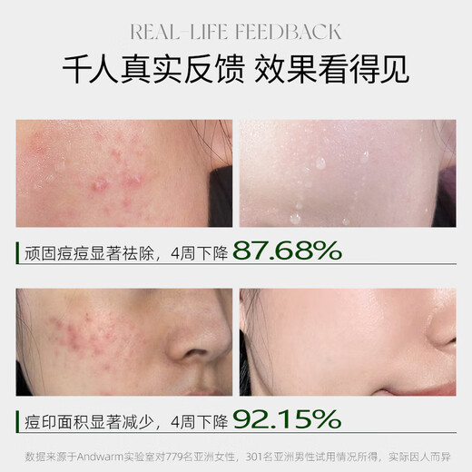 Andwarm Japan imported acne scars, azelaic acid salicylic acid acne removal cream acne removal essence acne pit repair redness and swelling acne men and women [Acne removal mites] acne removal cream + mite removal facial cleanser