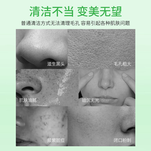 Renhe Ingenious Cleansing Mud Mask 100g Kaolin White Clay Oil Control Blackheads and Acne T Zone Moisturizing and Fine Pores Mask for Men and Women