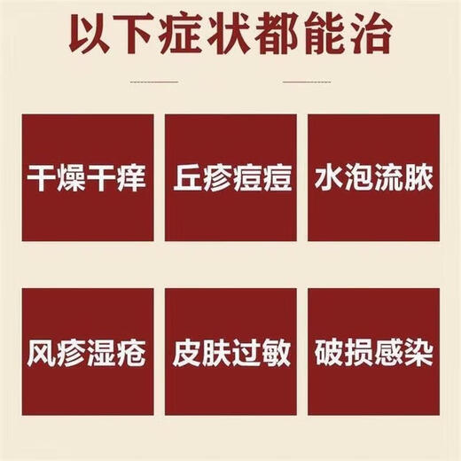 Special anti-itching medicine for skin, anti-itching skin itching, body itching, skin itching, dermatitis, eczema, fungi, stubborn eczema, anti-itching, removing the root of the disease, calamine lotion, for adults and babies, 1 box, 3 boxes, severe itching, waking up in the middle of the night due to itching, starting from the root, Fat Dong