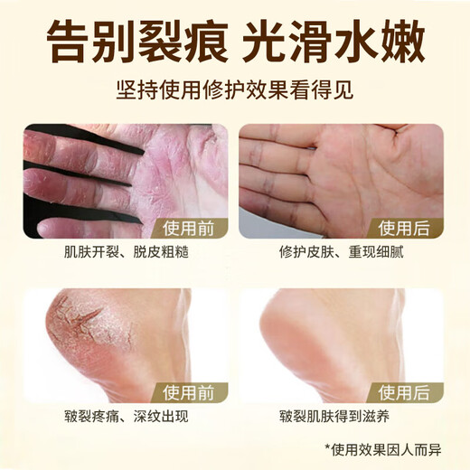 KOOGIS horse oil anti-cracking ointment for cracked hands and feet, horse oil ointment, Vaseline, cracked heels, cracked heels, hand cream