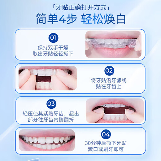SMILEKIT 炫白牙贴牙齿贴片温和亮白美去牙黄牙烟渍黑牙口气清新14对28贴