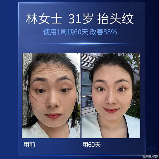 奈皙日本抗皱紧致面霜女男士护肤品胶原蛋白去衰老提拉保湿擦脸专用肽