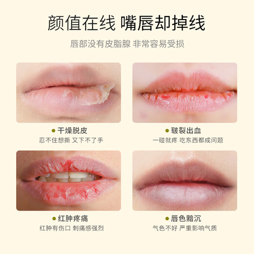 Qingniaoji Vaseline lip balm 3g*2 hydrating and moisturizing day and night soothing lip mask anti-drying and diluting lip lines colorless protection for men and women
