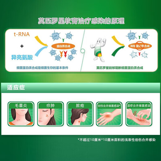 Official flagship Baiduoban Mupirocin Ointment Folliculitis Ointment for the treatment of folliculitis on the head. Medication for pimples and pustules on the head. Scalp itching to relieve itching, boils and swollen hair follicles. 1 box. The itching is unbearable. I can’t help but scratch it with my hands. The small amount is not recommended. The official flagship store’s authentic Fat Donglai selection line is available in Jingzi Dongying Pharmacy.