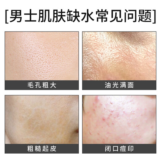 梵贞面膜美白面膜男士专用补水保湿淡化提亮肤色痘印熬夜皱纹细致毛孔 美白面膜5盒（量贩划算装）
