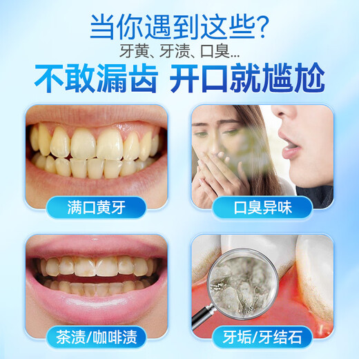 炫白洁牙粉洗牙粉去黄去牙渍去烟渍牙结石美白清洁刷牙粉刷白牙牙垢去口臭非益生菌牙膏口腔护理洗牙齿污垢