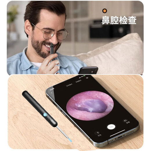 Shantou Lincun Ear Picking Artifact Ear Picking Tool Set Visual Ear Picking Spoon Luminous with Light Children's Home Ear Picking HD