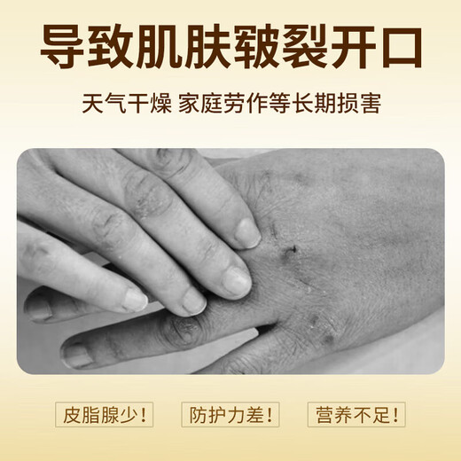 KOOGIS horse oil anti-cracking ointment for cracked hands and feet, horse oil ointment, Vaseline, cracked heels, cracked heels, hand cream