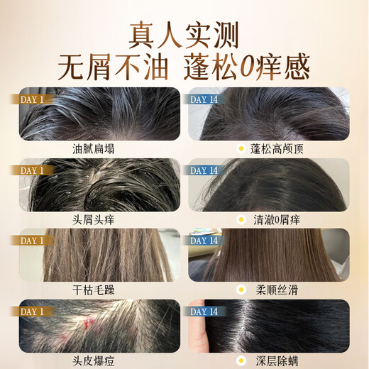 HIEUAILR德国进口原料洗发水男女专用除螨祛痘去屑止痒控油持久蓬松洗发露 【控油除螨祛痘】808ml*1