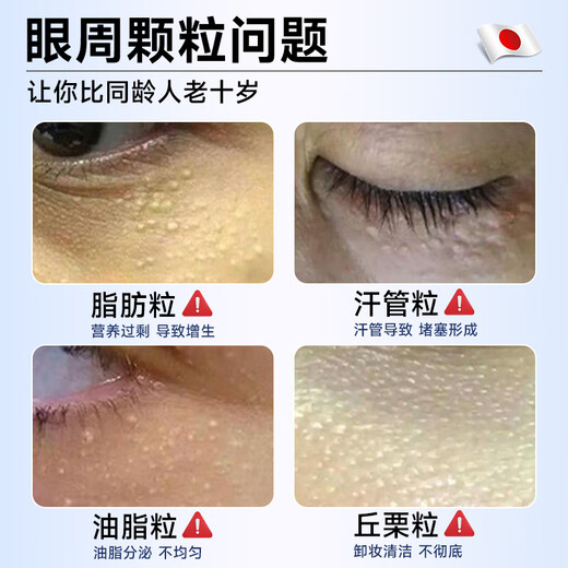 H18日本颗粒清肌眼霜脂肪粒去除眼部专用非药膏汗管去除药膏男女专用