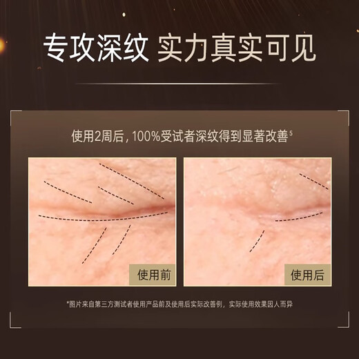 Yilisel Pure A Small Gold Tube A Alcohol Eye Lip Cream 15g Eye Cream Dimming Fine Lines Lifting Firming Dark Eye Circles