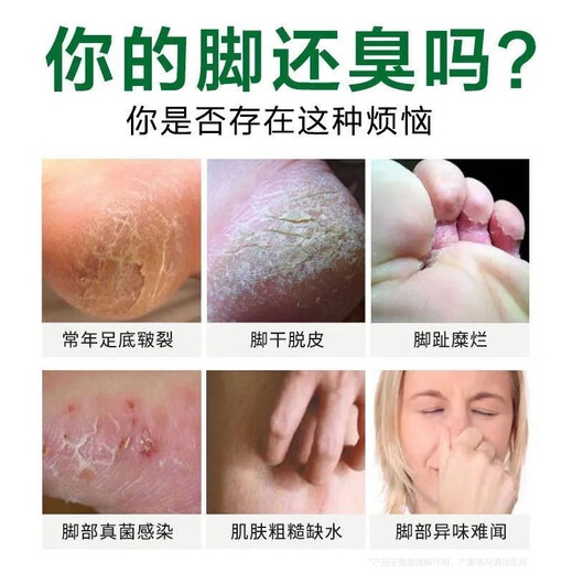 Tongrentang Athlete's Foot Spray Anti-itching Peeling Feet Sweat Blisters Itchy Feet Smelly Sweat Spray Wolfsbane Spray 60ml + Ointment 20g