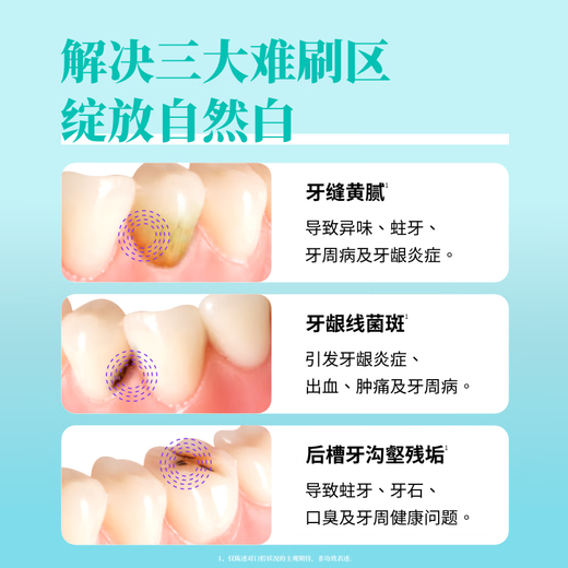 Huibaishi small round head toothbrush for adults, delicate and white teeth, small head, imported from Japan, medium hair 1 piece, random color