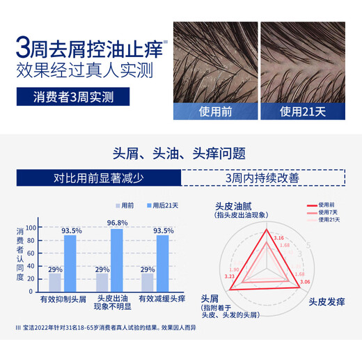 Haifei SI est spécialisé dans le shampooing anti-athi anti-voleur 470G