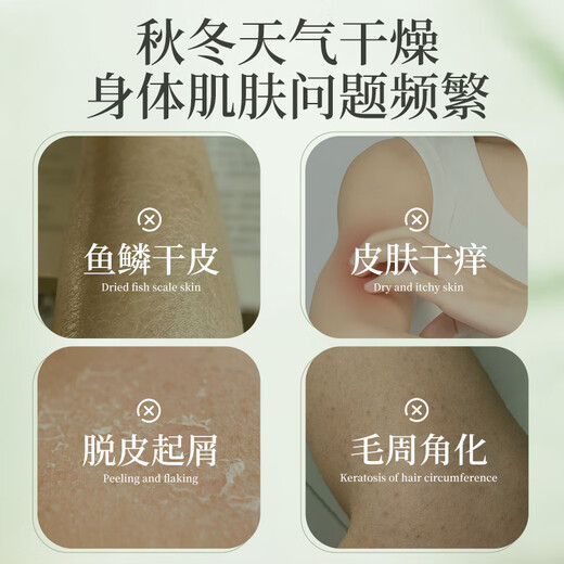 Centennial Bian's mugwort anti-itch body lotion, moisturizing, dry, peeling, hydrating body lotion, unisex, buy 1 get 1 free