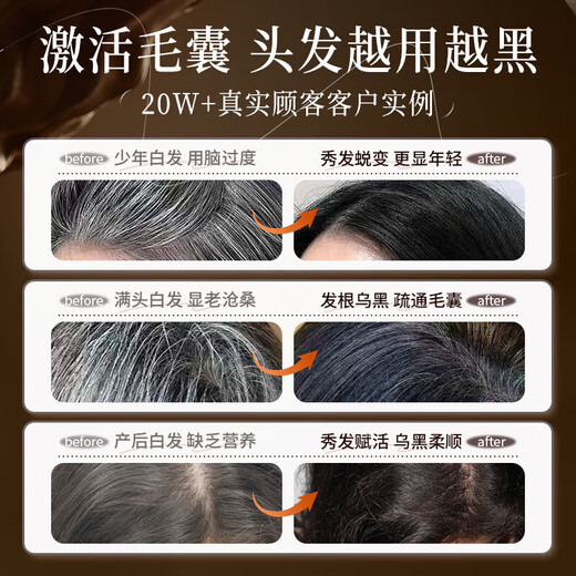 HIEUAILR Heshou Black Ganoderma Lucidum Shampoo Natural Black Hair Blossom and White Hair Turning Black to Treat Hair Roots and Prevent Loss