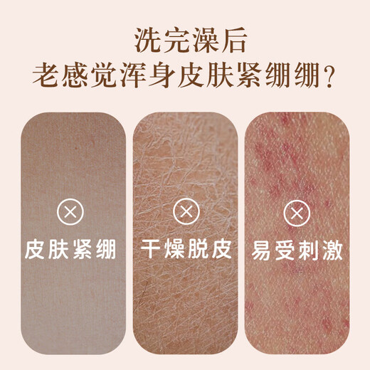 Yumeijing leche fresca después del baño loción 220g loción corporal leche hidratante e hidratante loción corporal hidratante