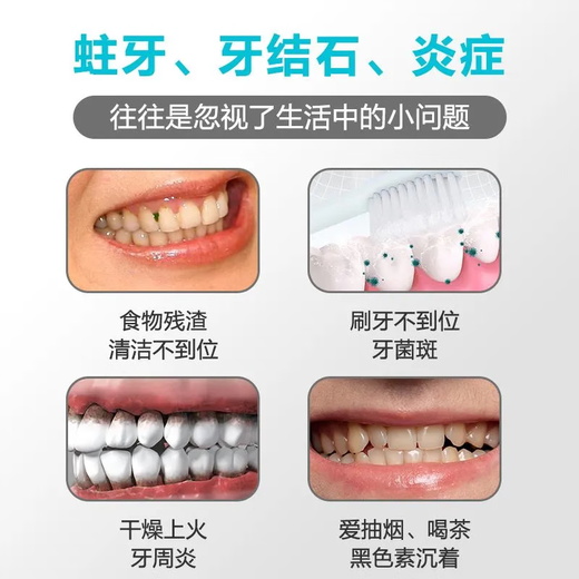 可孚医用口腔护理套装 牙结石牙齿清洁器口腔镜牙垢去除牙医牙科工具 五件套】口镜+牙科用钳+牙探针+锄型工具+镰型工具