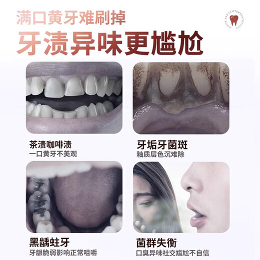 BKSK炫白健齿牙膏护龈清洁牙渍垢茶渍清新口气无异味樱花蜜桃官方正品 【实惠3支装】单支到手39.9