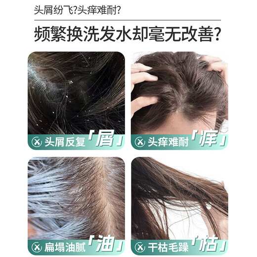 舒蕾氧活02Dynamic去屑止痒双证书洗发水750g顺滑