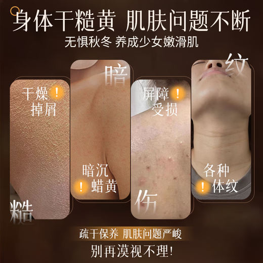 BEAI body lotion essential oil glycerin nourishes and moisturizes the skin in autumn and winter, relieves itchiness and long-lasting fragrance for women 150g