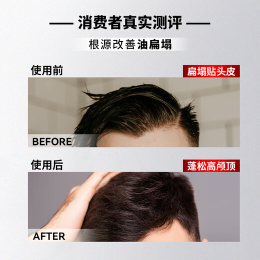 Alpecin Anti-dandruff and itchy hair loss dual-effect shampoo scalp repair shampoo anti-dandruff shampoo 200ml
