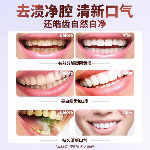BKSK炫白健齿牙膏护龈清洁牙渍垢茶渍清新口气无异味樱花蜜桃官方正品 【实惠3支装】单支到手39.9